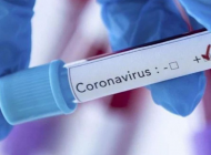 Koronavirüs tedavisi ücretsiz olacak